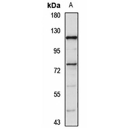 ZNF263 Rabbit Polyclonal Antibody