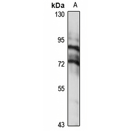 ZNF273 Rabbit Polyclonal Antibody