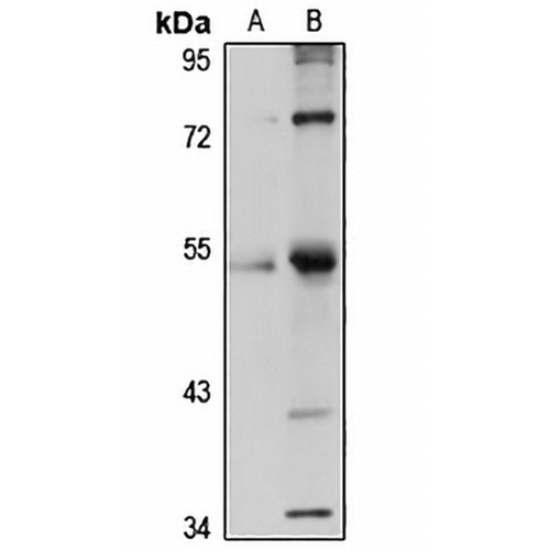 ZNF3 Rabbit Polyclonal Antibody