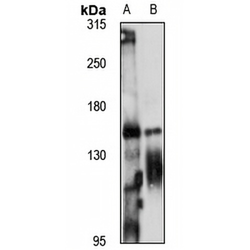 ZNF423 Rabbit Polyclonal Antibody