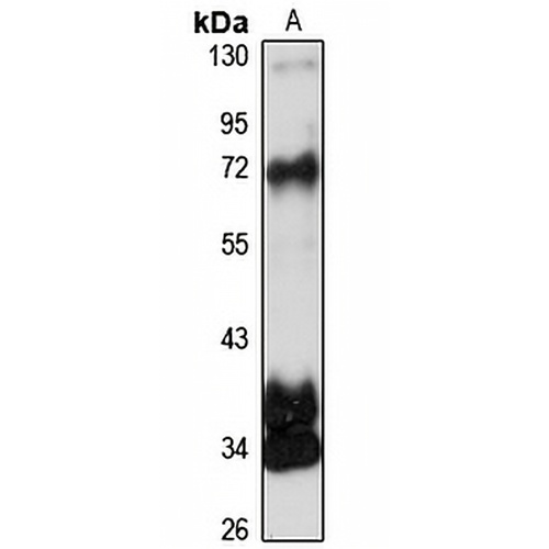 ZNF502 Rabbit Polyclonal Antibody