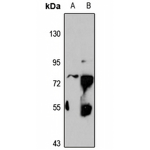 ZNF551 Rabbit Polyclonal Antibody