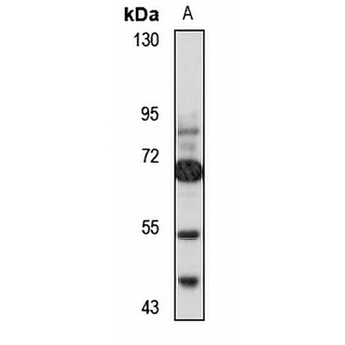 ZNF587 Rabbit Polyclonal Antibody