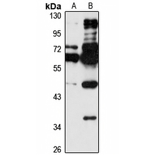ZNF597 Rabbit Polyclonal Antibody