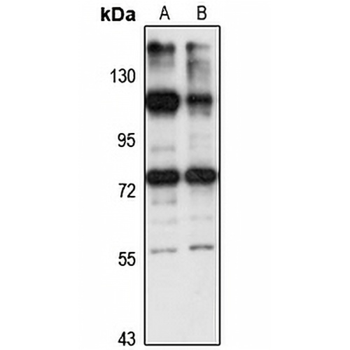 ZNF598 Rabbit Polyclonal Antibody