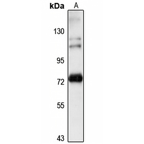 ZNF699 Rabbit Polyclonal Antibody