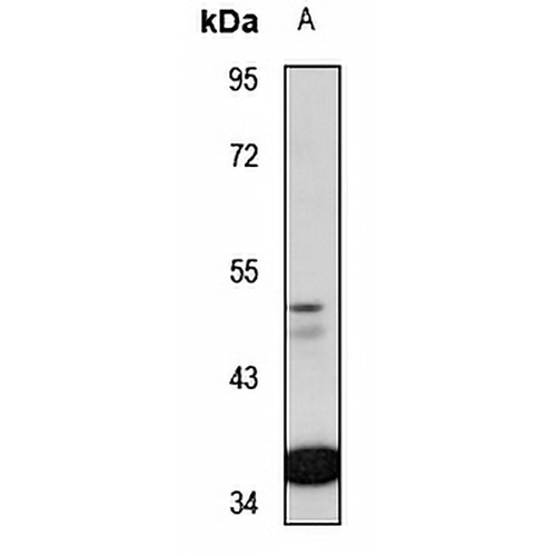ZNF701 Rabbit Polyclonal Antibody