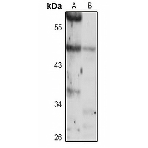 ZNF763 Rabbit Polyclonal Antibody