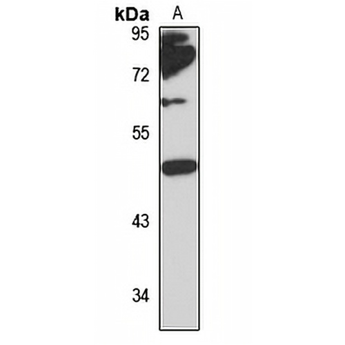 ZP3 Rabbit Polyclonal Antibody