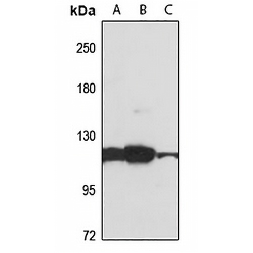 ZRANB3 Rabbit Polyclonal Antibody