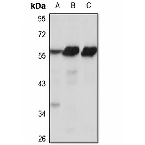 ZSCAN21 Rabbit Polyclonal Antibody
