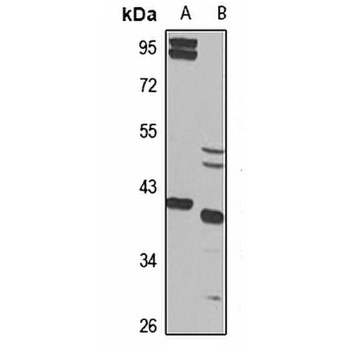ZWINT Rabbit Polyclonal Antibody