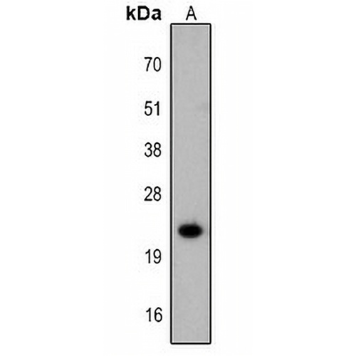FTMT Rabbit Polyclonal Antibody