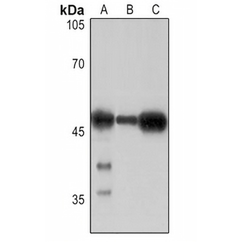 CD279 Rabbit Polyclonal Antibody
