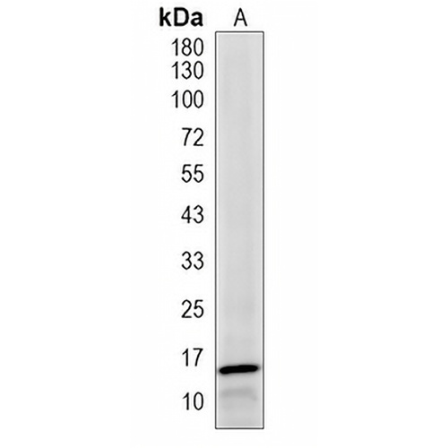 BNP Rabbit Polyclonal Antibody