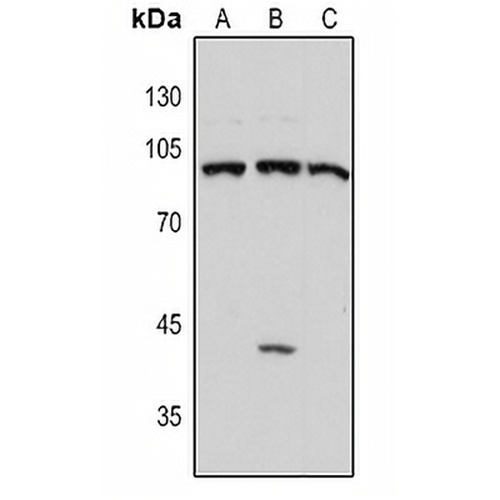 DNMT3B Rabbit Polyclonal Antibody