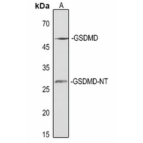 GSDMD-NT Rabbit Polyclonal Antibody