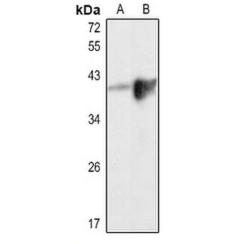 Arginase 1 Rabbit Polyclonal Antibody