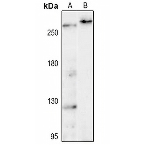 LRRK2 Rabbit Polyclonal Antibody