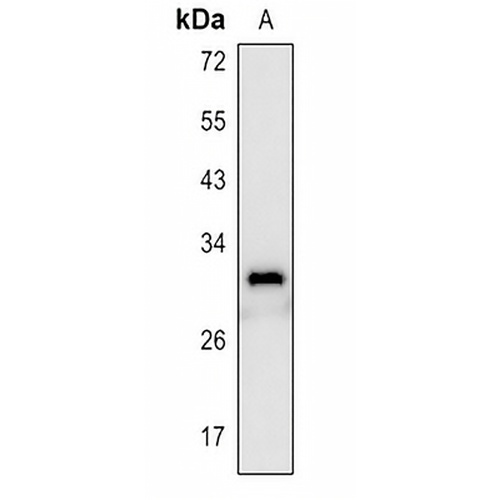 CD8a Rabbit Polyclonal Antibody