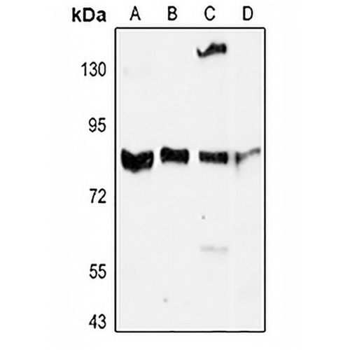 MMP9 Rabbit Polyclonal Antibody