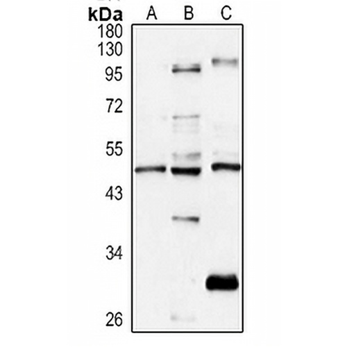 CCR3 Rabbit Polyclonal Antibody