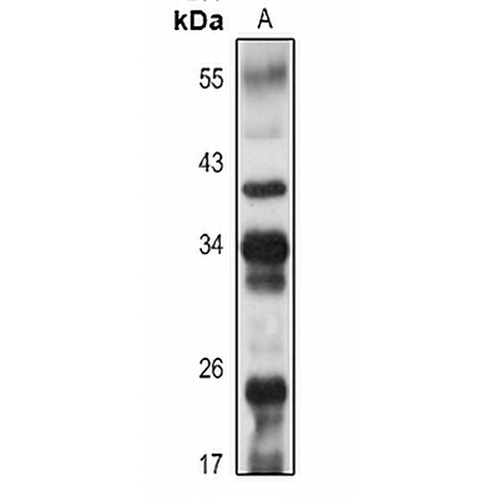 CD20 Rabbit Polyclonal Antibody