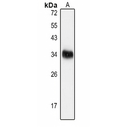 GDF15 Rabbit Polyclonal Antibody