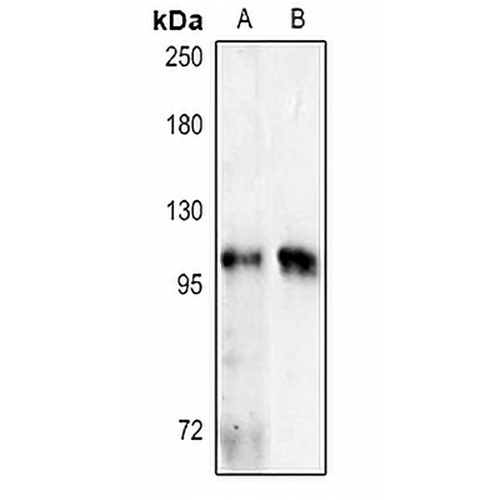 NOD2 Rabbit Polyclonal Antibody