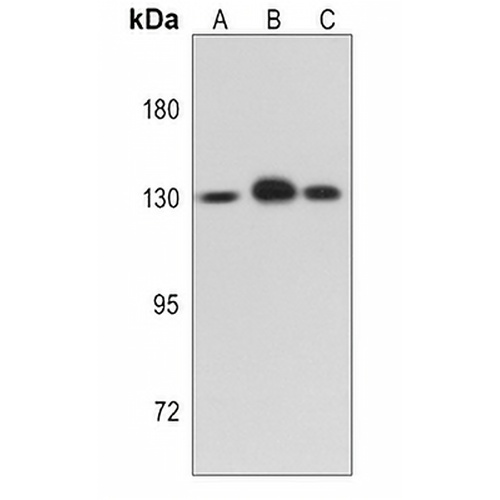 IRE1 Rabbit Polyclonal Antibody