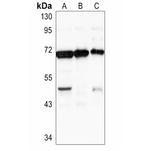 CHAT Rabbit Polyclonal Antibody