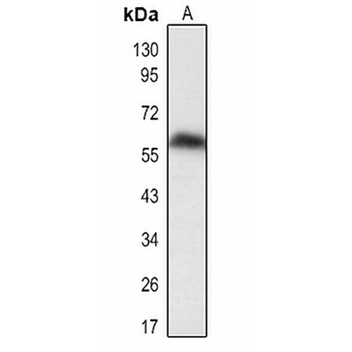 DUSP8 Rabbit Polyclonal Antibody