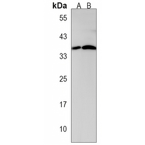 CTDSPL Rabbit Polyclonal Antibody
