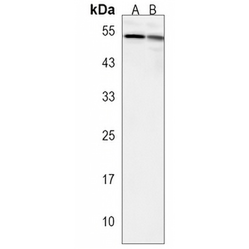 SCARA5 Rabbit Polyclonal Antibody