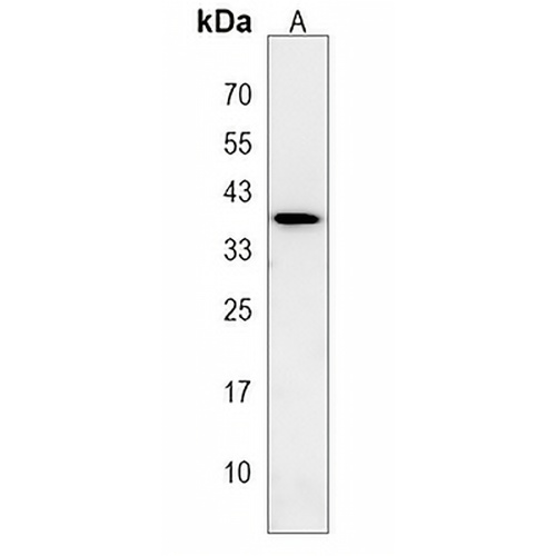 LGALS9B Rabbit Polyclonal Antibody