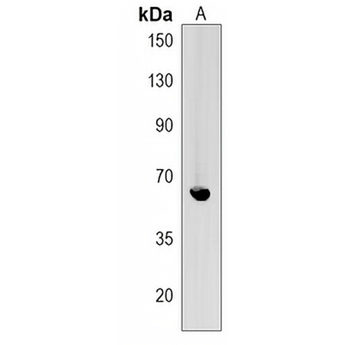 TMEM214 Rabbit Polyclonal Antibody