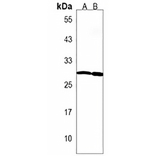LAPTM5 Rabbit Polyclonal Antibody