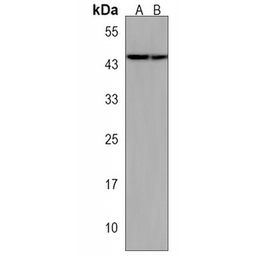TFB2M Rabbit Polyclonal Antibody