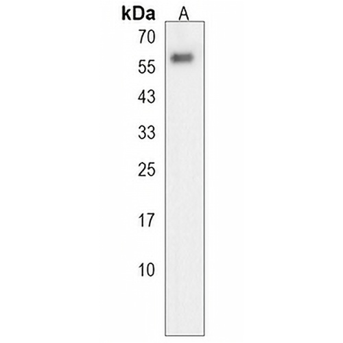 GALNT4 Rabbit Polyclonal Antibody