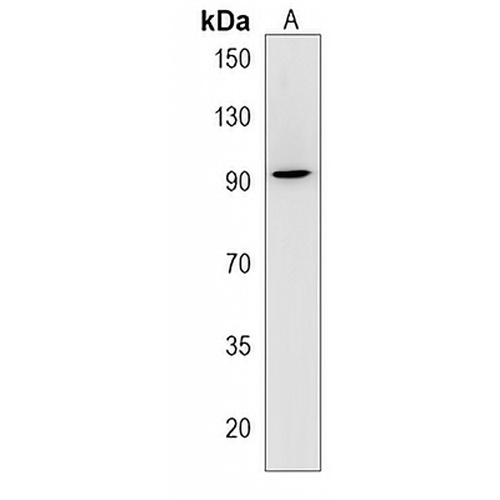 Hevin Rabbit Polyclonal Antibody