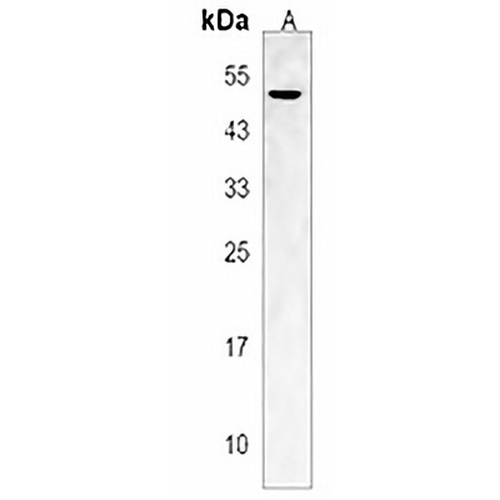 GCNT2 Rabbit Polyclonal Antibody