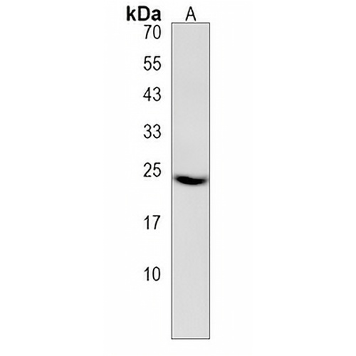 Claudin 22 Rabbit Polyclonal Antibody