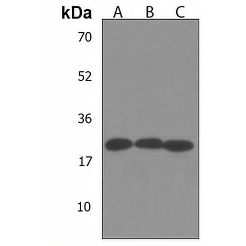 PEMT Rabbit Polyclonal Antibody