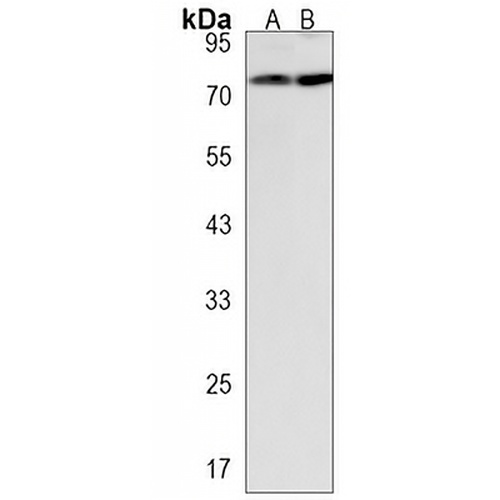 NSUN7 Rabbit Polyclonal Antibody