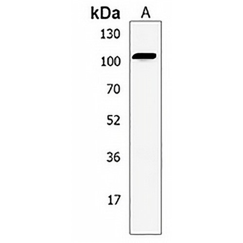 EFTUD1 Rabbit Polyclonal Antibody