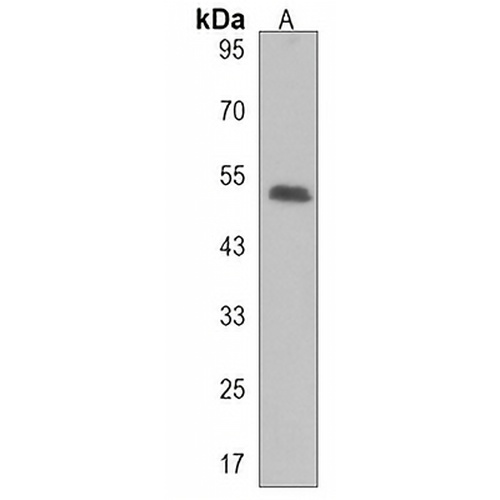 DENND1B Rabbit Polyclonal Antibody
