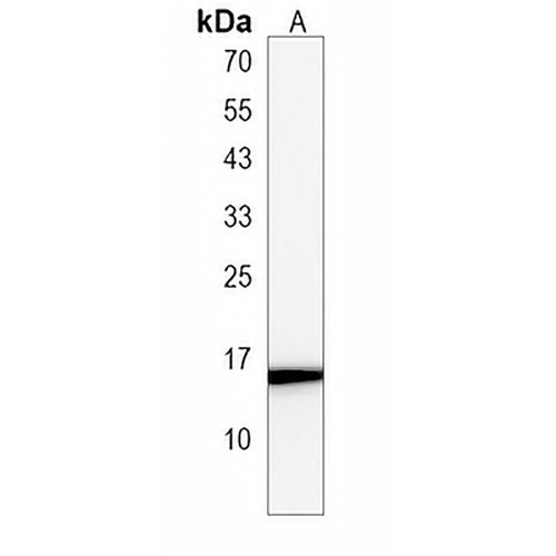 ATP6V0B Rabbit Polyclonal Antibody