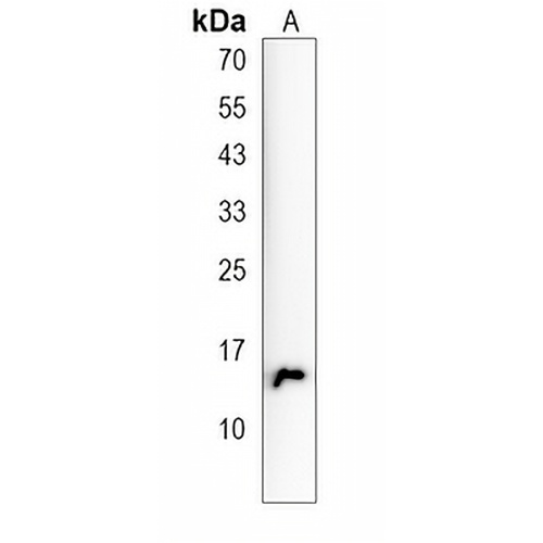 ENSA Rabbit Polyclonal Antibody