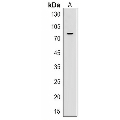 ATF7IP2 Rabbit Polyclonal Antibody