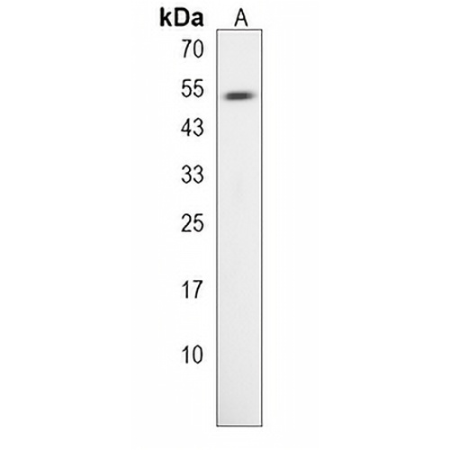 TLDC1 Rabbit Polyclonal Antibody